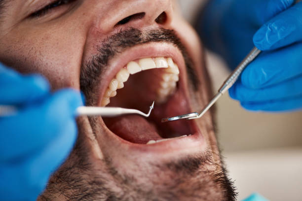Best Broken or Chipped Tooth Repair in Belville, NC